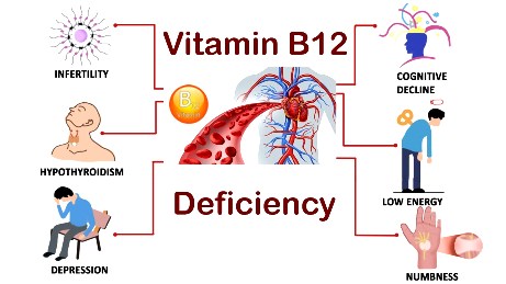 vit-vitamin-b12-deficiency-symptoms